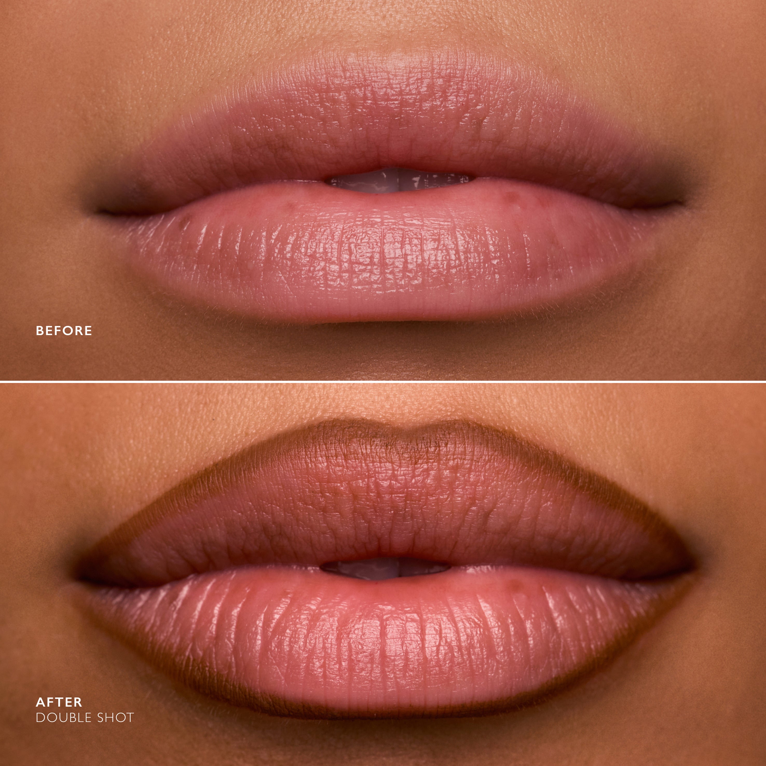 Before and after comparison of lips with a double shot effect.